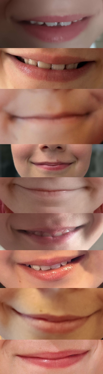 1000010559